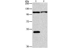 Western Blotting (WB) image for anti-NLR Family, Pyrin Domain Containing 3 (NLRP3) antibody (ABIN2427660) (NLRP3 抗体)
