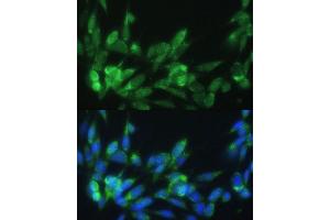 Immunofluorescence analysis of NIH-3T3 cells using LRP Polyclonal Antibody (ABIN3017160, ABIN3017161, ABIN1680715 and ABIN6219979) at dilution of 1:100 (40x lens). (LRPAP1 抗体)