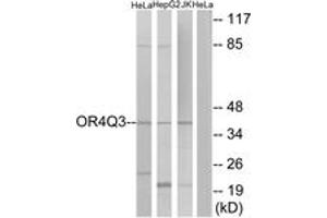 Western blot analysis of extracts from HeLa/Jurkat/HepG2 cells, using OR4Q3 Antibody.