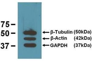EBI’s three loading control mAbs reacting against 10μg/lane of mouse brain tissue lysates. (TUBB 抗体)