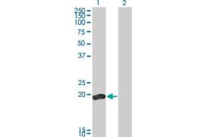 Western Blot analysis of DUSP3 expression in transfected 293T cell line by DUSP3 monoclonal antibody (M01), clone 5B7. (Dual Specificity Phosphatase 3 (DUSP3) (AA 1-185) 抗体)