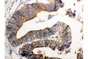 IHC(P): Human Intestinal Tissue (NMI 抗体  (AA 2-307))