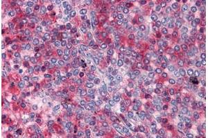 Human Spleen: Formalin-Fixed, Paraffin-Embedded (FFPE) (RRM2 抗体  (AA 1-111))