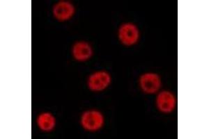 ABIN6278379 staining 293T by IF/ICC. (SSB 抗体  (Internal Region))