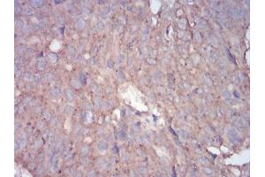 Immunohistochemistry (IHC) image for anti-Ras-related Protein Ral-A (rala) (AA 71-203) antibody (ABIN5542386)