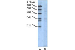 WB Suggested Anti-CCNB3 Antibody Titration:  2.