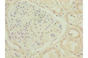 Immunohistochemistry of paraffin-embedded human kidney tissue using ABIN7174751 at dilution of 1:100 (C17ORF47 抗体  (AA 1-300))
