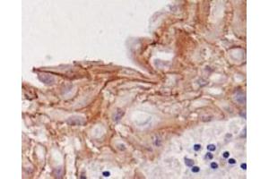 Image no. 1 for anti-Desmoglein 3 (DSG3) antibody (ABIN1721896) (Desmoglein 3 抗体)