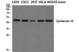Western Blot (WB) analysis of specific cells using Cytokeratin 18 Polyclonal Antibody. (Cytokeratin 18 抗体  (C-Term))