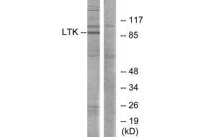 Western Blotting (WB) image for anti-Leukocyte Receptor tyrosine Kinase (LTK) (Internal Region) antibody (ABIN1849300) (LTK 抗体  (Internal Region))