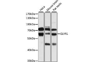 Western blot analysis of extracts of various cell lines, using GLYR1 antibody (ABIN6133101, ABIN6141170, ABIN6141171 and ABIN6224873) at 1:1000 dilution.