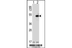 Western blot analysis of SPHK1 using rabbit polyclonal using 293 cell lysates (2 ug/lane) either nontransfected (Lane 1) or transiently transfected (Lane 2) with the SPHK1 gene. (SPHK1 抗体  (C-Term))