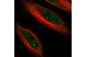 Immunofluorescent staining of human cell line HeLa with CDKN1C polyclonal antibody  at 1-4 ug/mL concentration shows positivity in nucleus but excluded from the nucleoli. (CDKN1C 抗体)