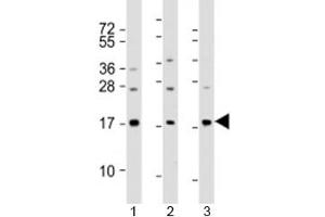 Western blot testing of human 1) A549, 2) HeLa and 3) spleen lysate with PLA2 antibody at 1:2000. (PLA2G1B 抗体  (AA 106-135))