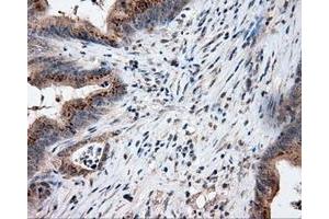 Image no. 2 for anti-Lipase, Endothelial (LIPG) antibody (ABIN1499163) (LIPG 抗体)