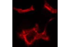 ABIN6279729 staining HeLa cells by IF/ICC. (RAB1B 抗体  (Internal Region))