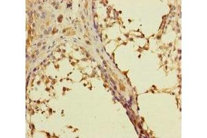 Immunohistochemistry of paraffin-embedded human testis tissue using ABIN7167274 at dilution of 1:100 (RAB27B 抗体  (AA 1-218))