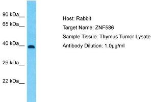 Host: Rabbit Target Name: ZNF586 Sample Type: Thymus Tumor lysates Antibody Dilution: 1. (ZNF586 抗体  (Middle Region))