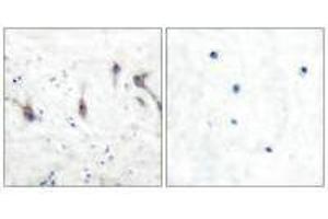 Immunohistochemical analysis of paraffin-embedded human brain tissue using ARC antibody. (ARC 抗体)