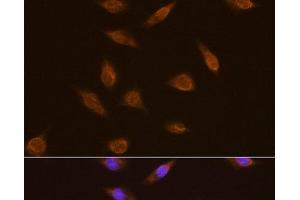 Immunofluorescence analysis of L929 cells using TSG101 Polyclonal Antibody at dilution of 1:100. (TSG101 抗体)