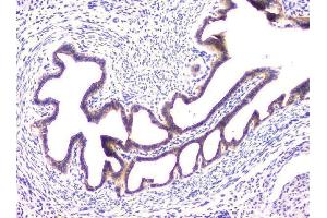 IHC analysis of RAB11B using anti-RAB11B antibody (ABIN6719364).