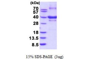SDS-PAGE (SDS) image for Nucleotide Binding Protein 1 (NUBP1) (AA 1-320) protein (His tag) (ABIN5854180)