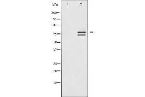Western blot analysis of Lamin A/C expression in HeLa whole cell lysates,The lane on the left is treated with the antigen-specific peptide. (Lamin A/C 抗体  (Internal Region))