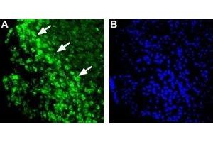 Expression of Histamine H1 receptor in mouse brain - Immunohistochemical staining of mouse ventromedial hypothalamus (VMH) using Anti-Histamine H1 Receptor (HRH1) Antibody (ABIN7043268, ABIN7044505 and ABIN7044506). (HRH1 抗体  (3rd Intracellular Loop))