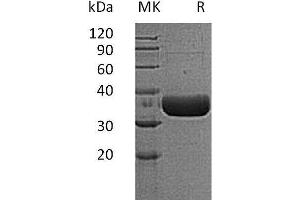 Western Blotting (WB) image for Tryptase beta 2 (TPSB2) protein (His tag) (ABIN7320763) (TPSB2 Protein (His tag))