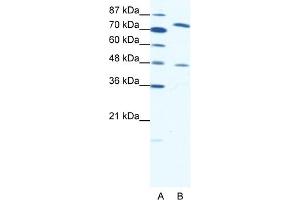 WB Suggested Anti-ZNF225 Antibody Titration:  0. (ZNF225 抗体  (N-Term))