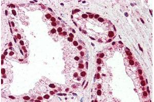 Human Prostate (formalin-fixed, paraffin-embedded) stained with IRF6 antibody ABIN461925 at 2. (IRF6 抗体  (AA 455-467))