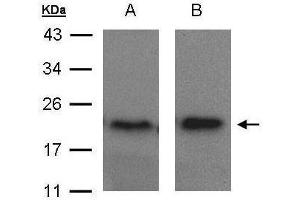 WB Image Sample(30 μg of whole cell lysate) A:MOLT4, B:Raji, 15% SDS PAGE antibody diluted at 1:1500 (ARF5 抗体)