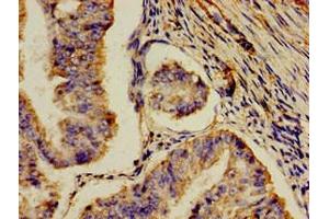 Immunohistochemistry (IHC) image for anti-Amine Oxidase, Copper Containing 3 (Vascular Adhesion Protein 1) (AOC3) (AA 27-259) antibody (ABIN7159328)