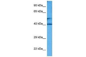 Host:  Rabbit  Target Name:  CKM  Sample Tissue:  Mouse Small Intestine  Antibody Dilution:  1ug/ml (CKM 抗体  (Middle Region))