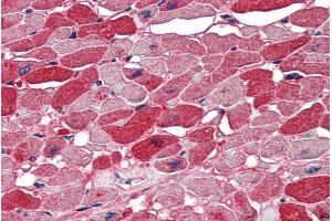 Immunohistochemistry (IHC) image for anti-Neuro-Oncological Ventral Antigen 1 (NOVA1) (Internal Region) antibody (ABIN334449)