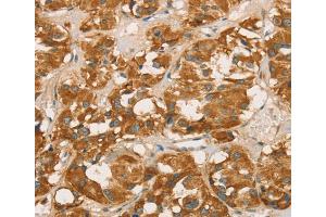 Immunohistochemistry (IHC) image for anti-Retinoblastoma Binding Protein 8 (RBBP8) antibody (ABIN2423210) (Retinoblastoma Binding Protein 8 抗体)