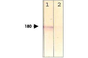 The cell lysate derived from conditioned NIH/3T3 was immunoprobed by LRP6 (phospho T1479) polyclonal antibody  at 1 : 500. (LRP6 抗体  (pThr1479))