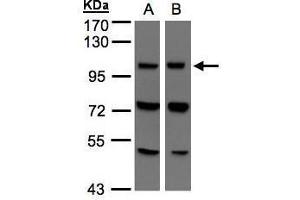 WB Image Sample(30 μg of whole cell lysate) A:293T B:Hep G2, 7. (VPS11 抗体  (Center))