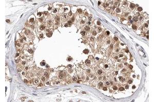 ABIN6268782 at 1/100 staining human testis tissue sections by IHC-P. (PKM 抗体  (Internal Region))