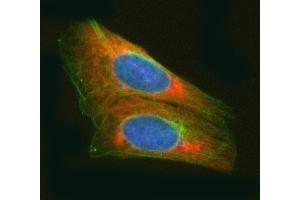 IF analysis of RARS/RARS1 using anti-RARS/RARS1 antibody (ABIN7600223) and anti-Tubulin Alpha antibody (ABIN7600339). (Probable Arginine--tRNA Ligase, Cytoplasmic (RARS-1) (AA 165-425) 抗体)