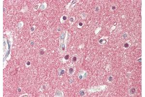 Rabbit Anti-SV2A antibody  Formalin Fixed Paraffin Embedded Tissue: Human Brain, Cortex Primary antibody Concentration: 1:100 Secondary Antibody: Donkey anti-Rabbit-Cy3 Secondary Antibody Concentration: 1:200 Magnification: 20x Exposure Time: 0. (SV2A 抗体  (Middle Region))