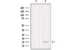 Western blot analysis of extracts from Hela, using INSL5 Antibody. (INSL5 抗体)