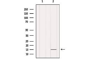Western blot analysis of extracts from Hela, using INSL5 Antibody.