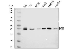 Western blot analysis of GHITM using anti-GHITM antibody (ABIN7599294).