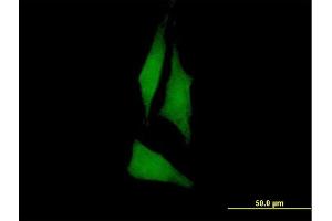 Immunofluorescence of purified MaxPab antibody to PTK6 on HeLa cell. (PTK6 抗体  (AA 1-451))