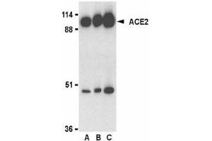 Western blot analysis of ACE2 in human kidney lysate with AP30007PU-N ACE2 antibody at 0. (ACE2 抗体  (C-Term))
