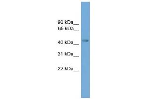 WB Suggested Anti-ERCC8 Antibody Titration: 0. (ERCC8 抗体  (Middle Region))