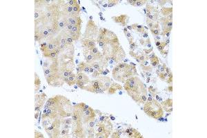 Immunohistochemistry of paraffin-embedded human stomach using CETN3 antibody. (CETN3 抗体  (AA 1-167))