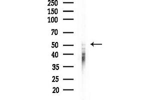 Western blot analysis of lysates from COLO205 cells, using Phospho-p70 S6 Kinase beta (Ser423) Antibody at 1/1000 dilution.