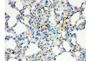 Immunohistochemistry (IHC) image for anti-Integrin Alpha2b (CD41) (AA 677-711), (C-Term) antibody (ABIN3043254)
